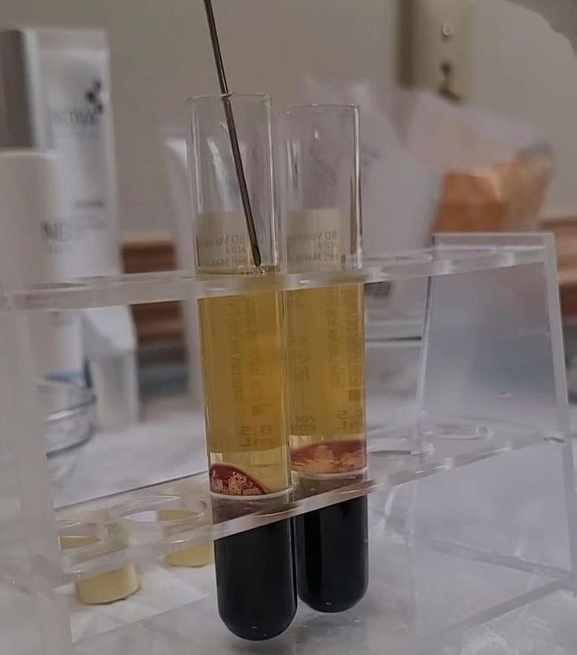 BIOESTIMULACIÓN AUTÓLOGA